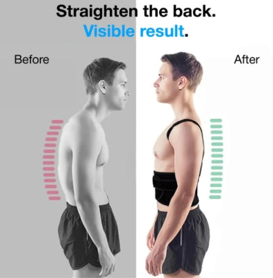 Back Posture Corrector